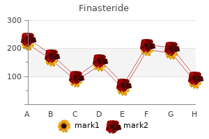 buy generic finasteride 5mg line